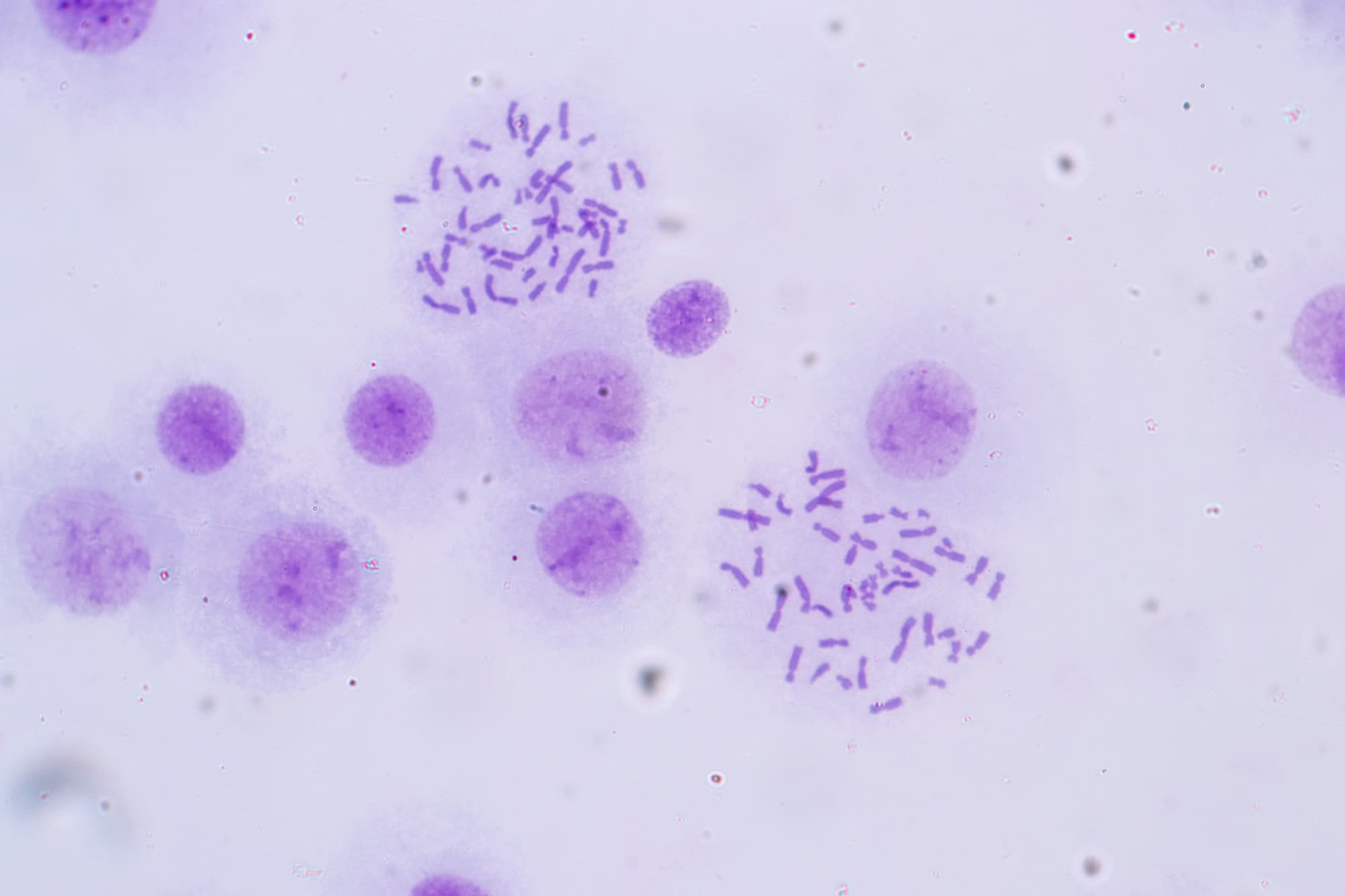 Understanding the organisation of our DNA to intercept disease