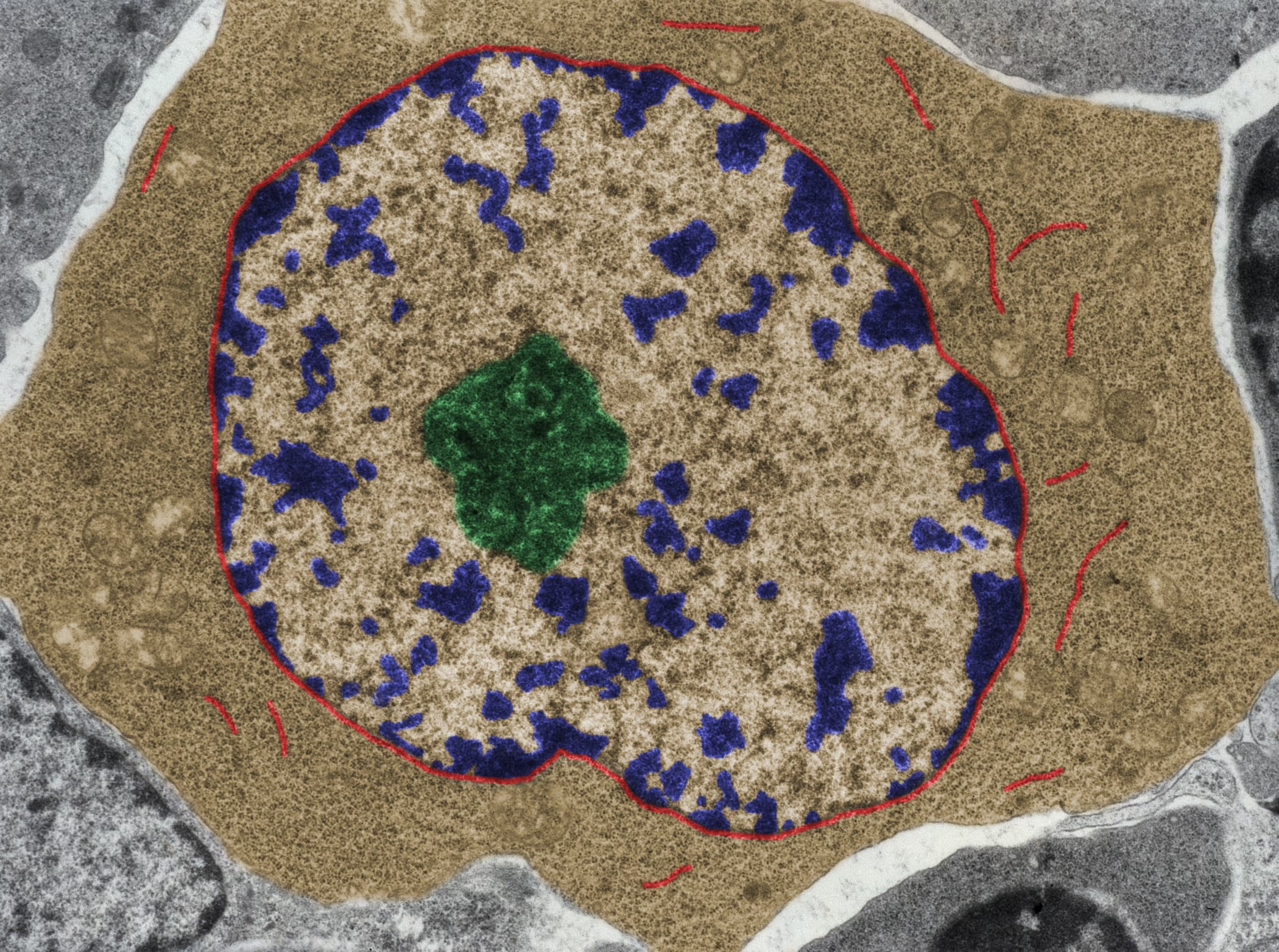 Understanding the human genome to treat cancer