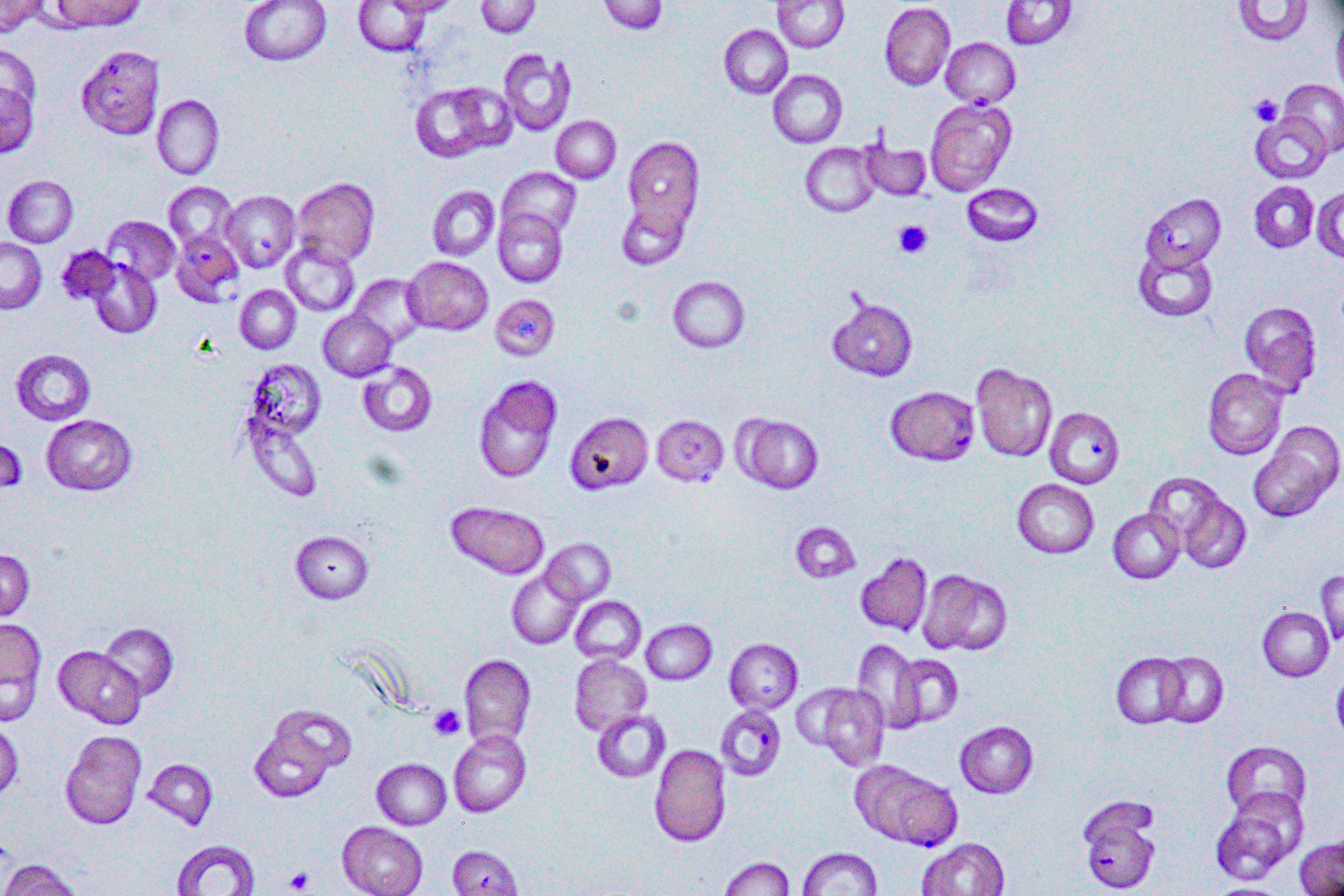 The malaria parasite