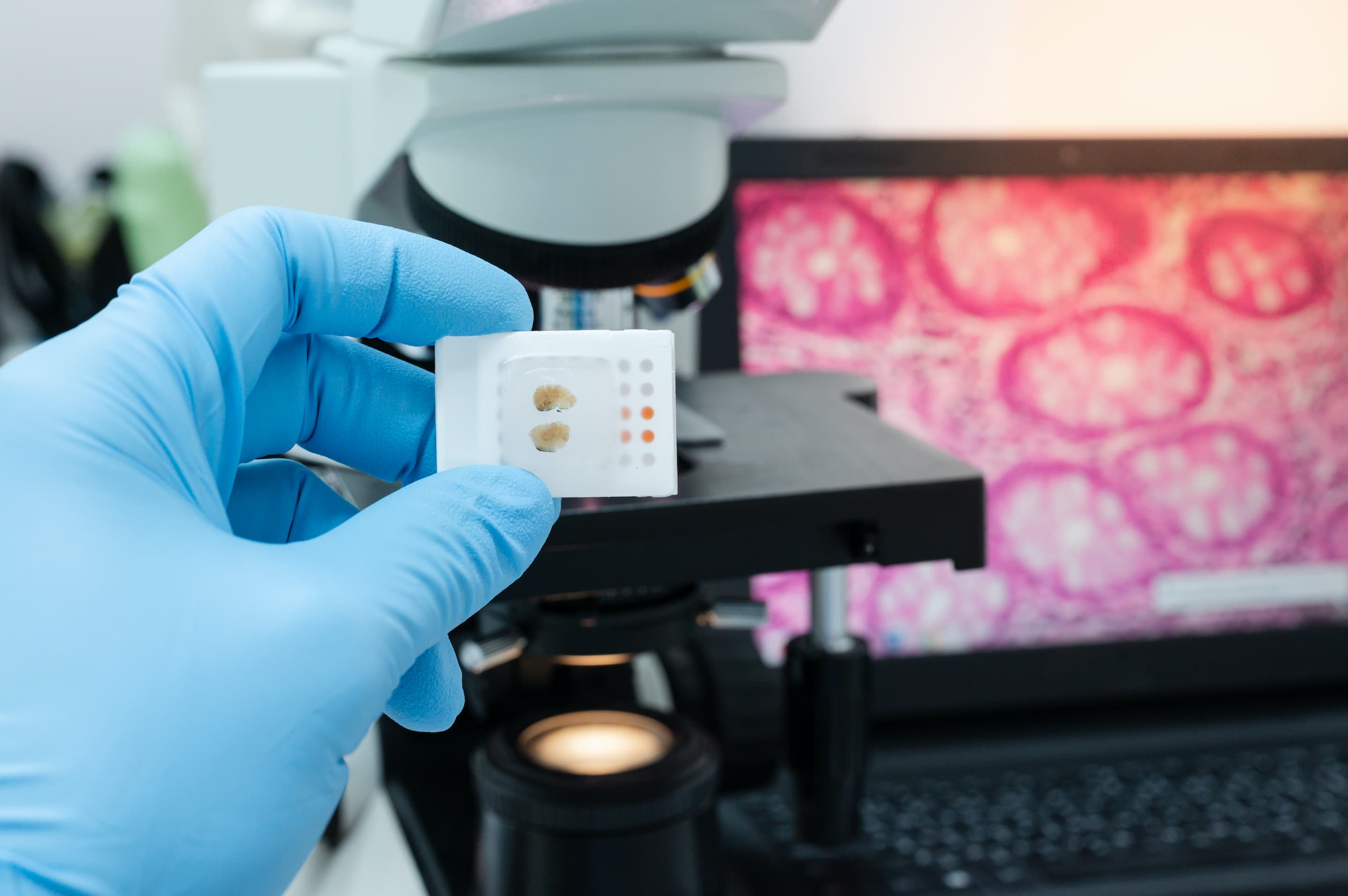 Cancer cells and genetic alteration